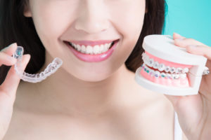 Read more about the article Common Types of Braces